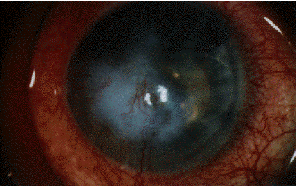 Cliquez sur l'icone 
pour visualiser l'image